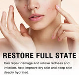 Eelhoe Snail Protein Repair Cream Tightens.