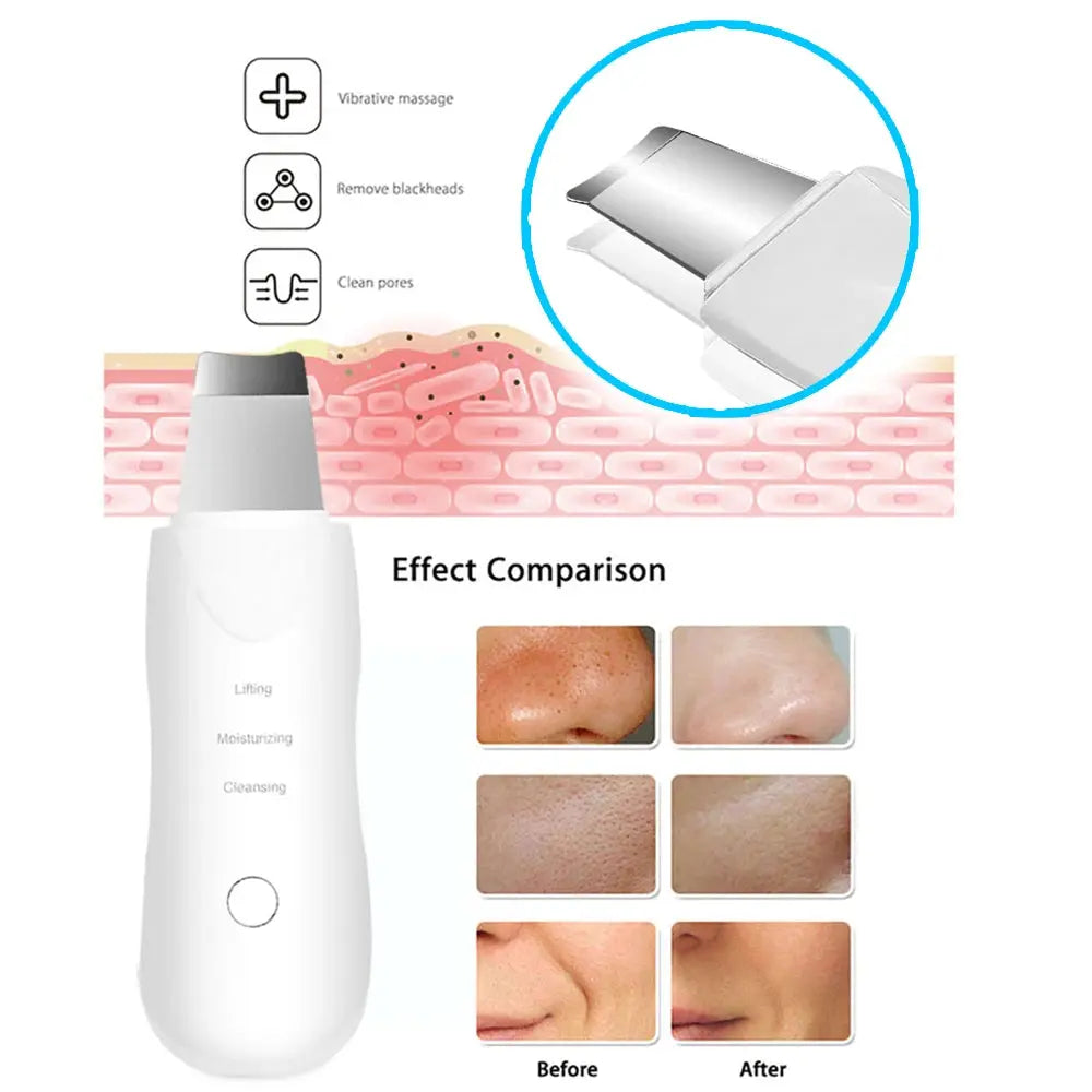 Ultrasonic Skin Scrubber Electric Ultrasonic.