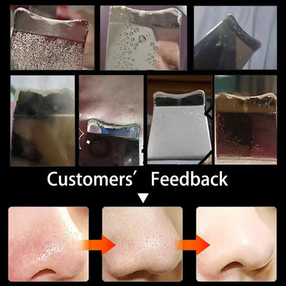 Electric Skin Scrubber Peeling Blackhead Remover.