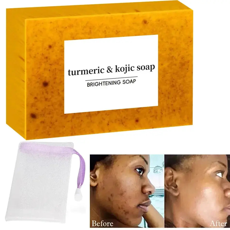 Turmeric Kojic Acid Glow Soap Dark Spot Acne.