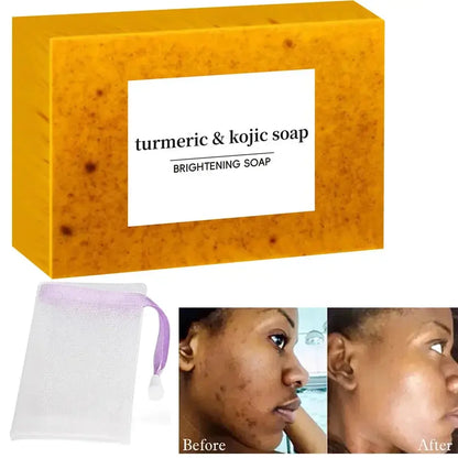 Turmeric Kojic Acid Glow Soap Dark Spot Acne.