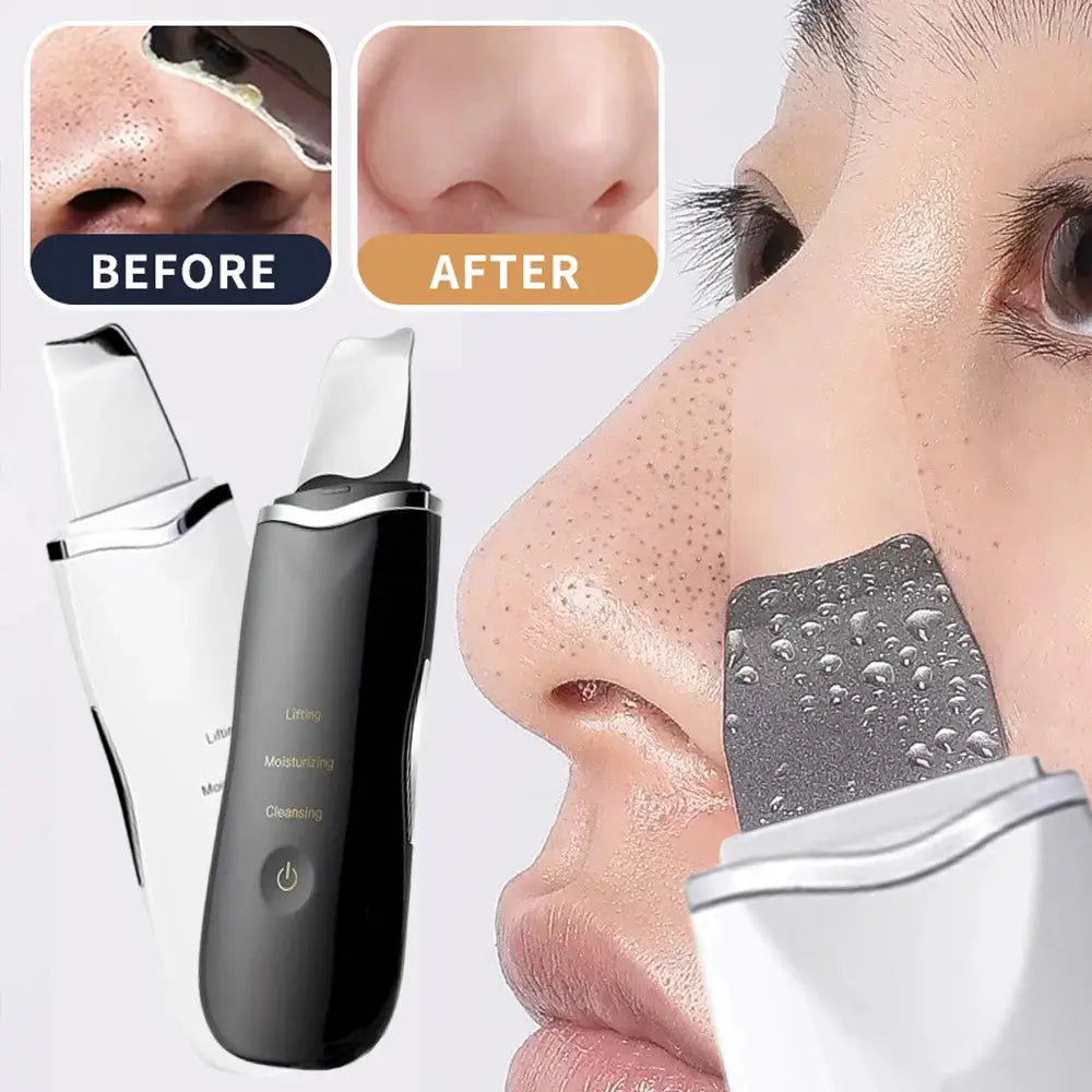 Electric Skin Scrubber Peeling Blackhead Remover.