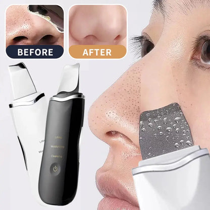 Electric Skin Scrubber Peeling Blackhead Remover.