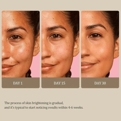 Turmeric Kojic Acid Glow Soap Dark Spot Acne.