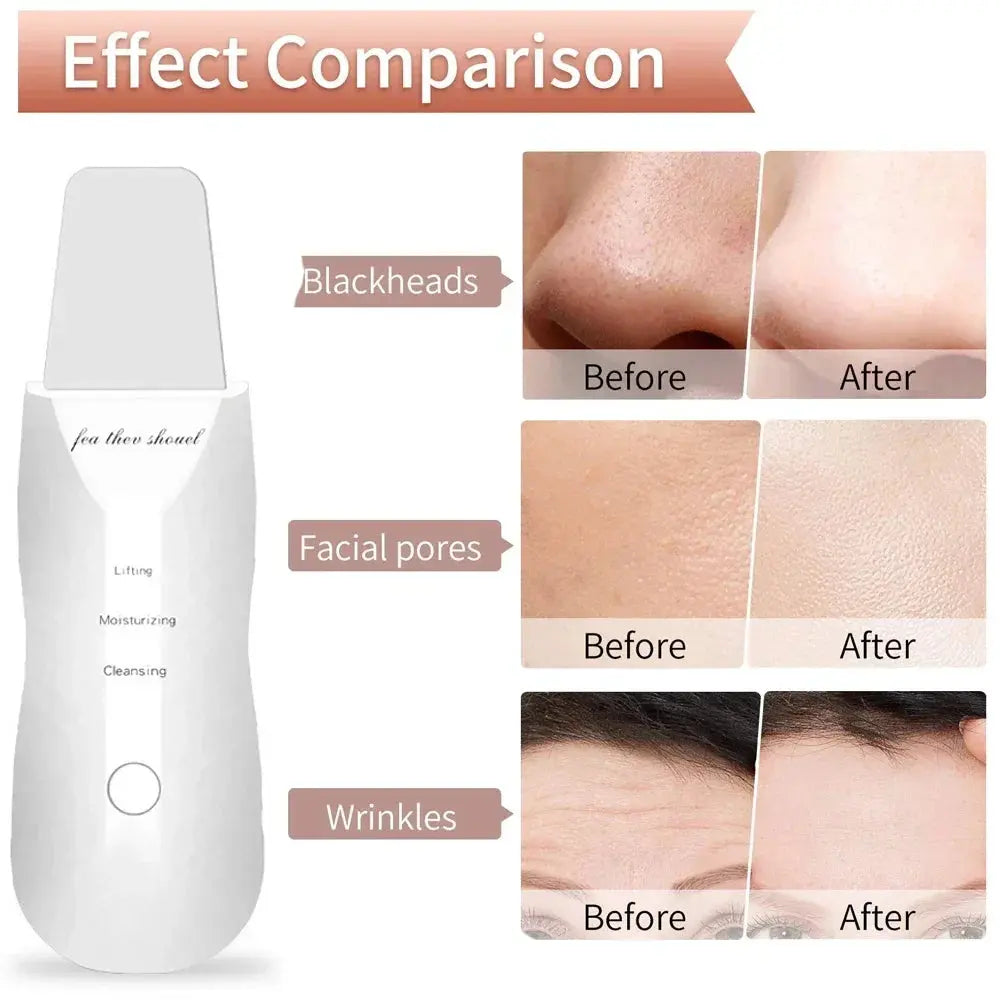 Electric Skin Scrubber Peeling Blackhead Remover.
