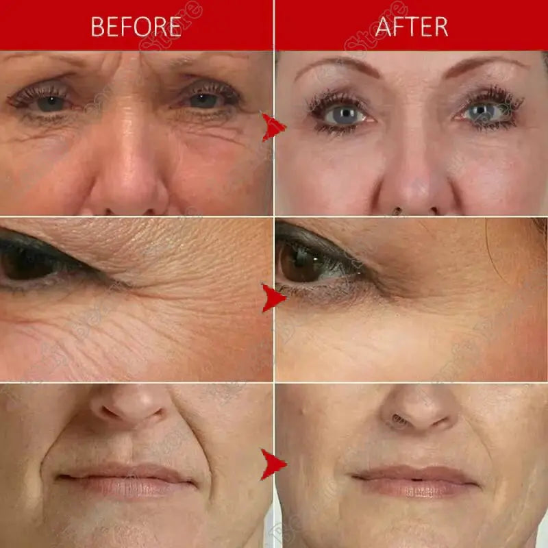 Instant Wrinkle Remover Face Cream Collagen.