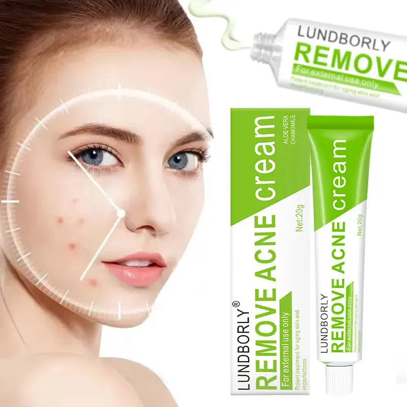 Natural Herbal Face Cream 20g Acne Cream.