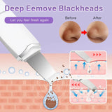 Facial Skin Scrubber Face Spatula Exfoliator.